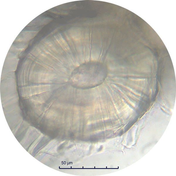 Singola sclereide nella pera